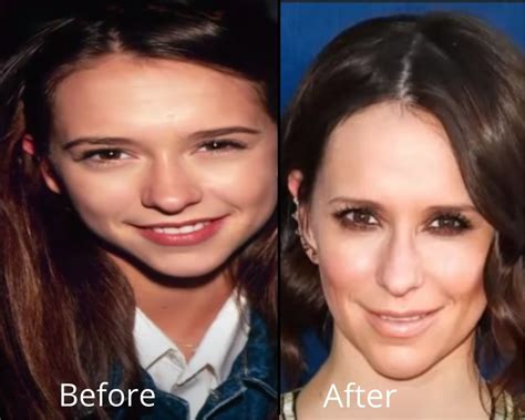 jennifer love hewitt plastic surgery|Jennifer Love Hewitt Responds To Plastic Surgery Speculation .